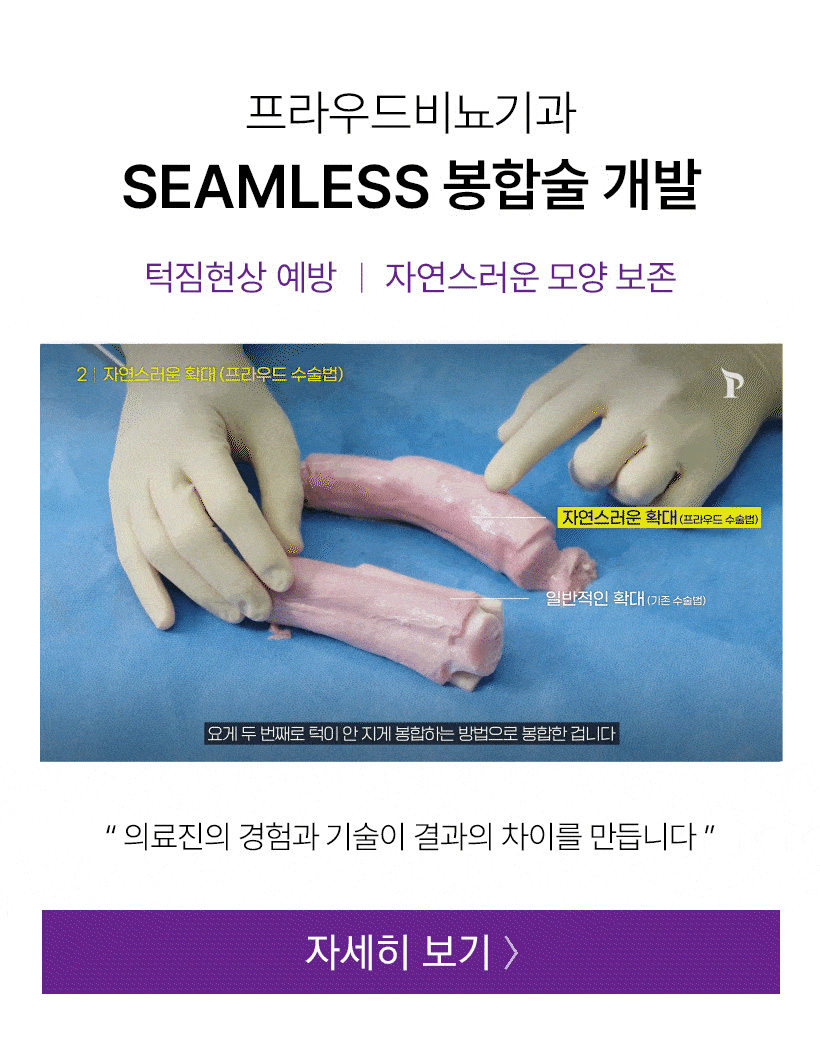 자연스러운 결과를 보기 위한 남성확대비용 3